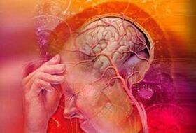 Syndrome de migraine au cou
