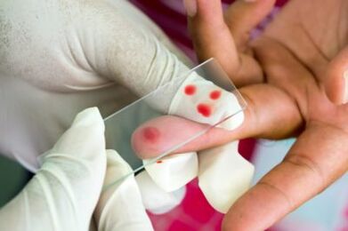 Diagnostic de douleur dans les articulations des doigts