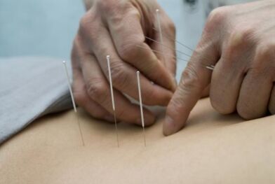 Acupuncture pour l'ostéochondrose de la région thoracique