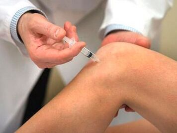 Injection dans l'articulation du genou pour l'arthrose